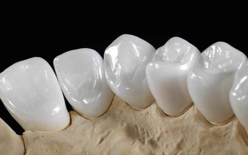 Răng sứ Zirconia Venus