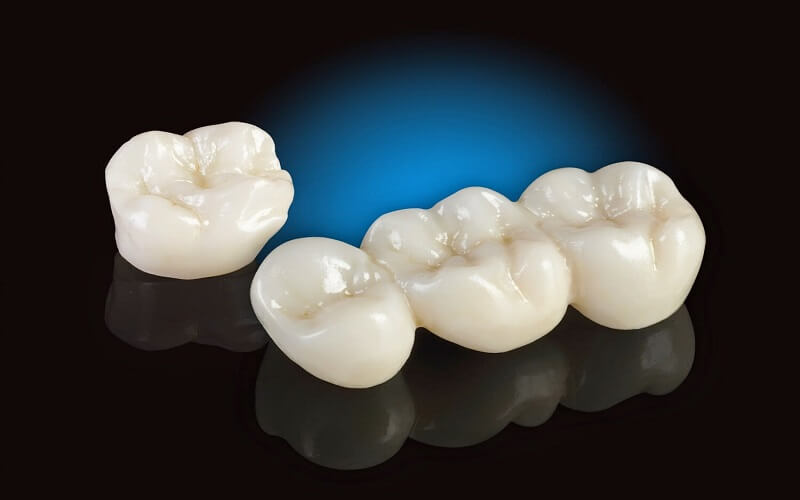 so-sanh-rang-su-cercon-va-ceramill