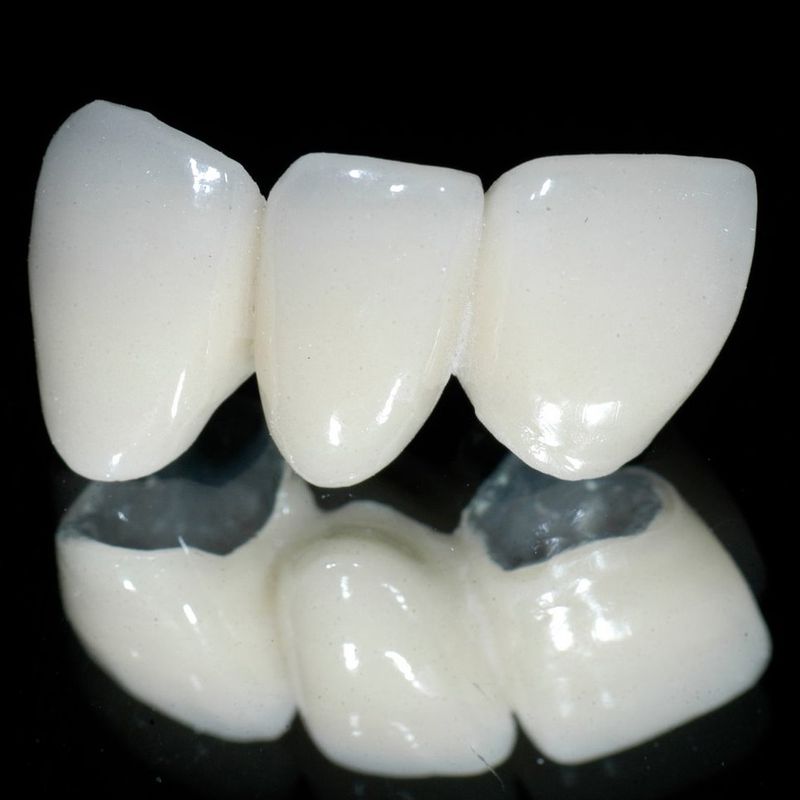 Răng sứ Cercon Zirconia bên ngoài được làm bằng sứ Cercon và bên trong là vật liệu Zirconia