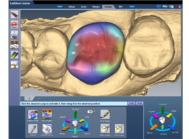 Công nghệ CAD/CAM 3D, Công nghệ VCeph 3D, Phần mềm phân tích Simplant 3D