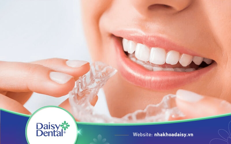 Niềng răng Invisalign tháo rời dễ dàng