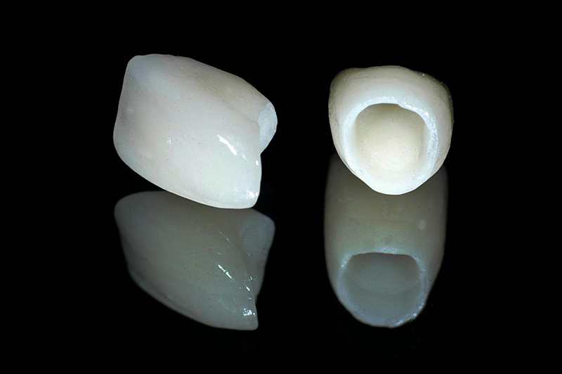 Rang-su-Zirconia