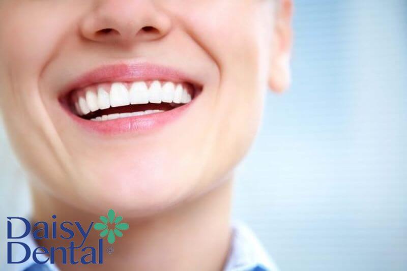 Ceramill mang lại giá trị thẩm mỹ cao cho người sử dụng