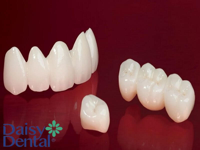 Răng sứ Ceramill