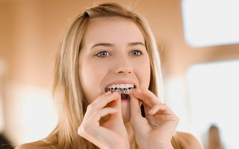 <eNiềng răng Invisalign đảm bảo tính thẩm mỹ và hiệu quả tối ưu nhất