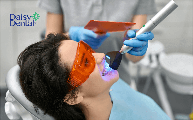 Tẩy trắng răng bằng Laser Whitening