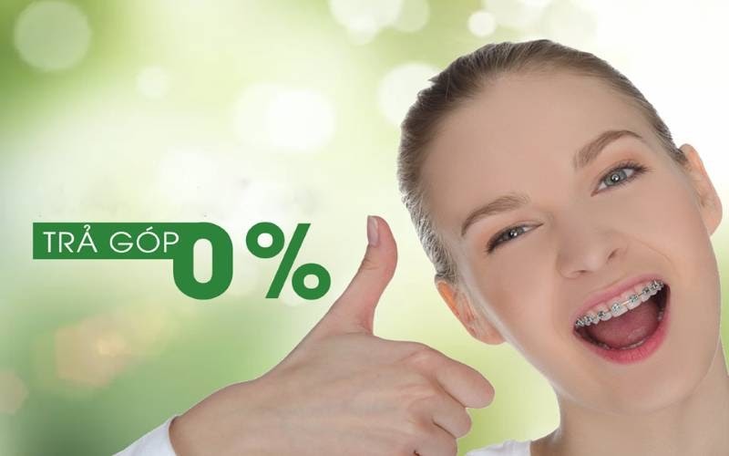 Làm răng trả góp 0% nhanh chóng, tiện lợi