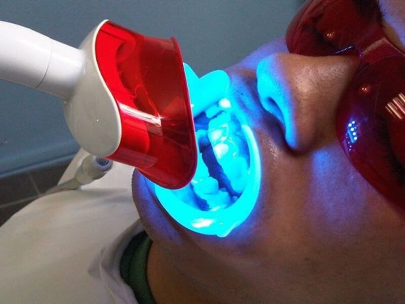 Cường độ ánh sáng đèn plasma khá mạnh nên có thể làm men răng yếu đi nếu dùng quá mức